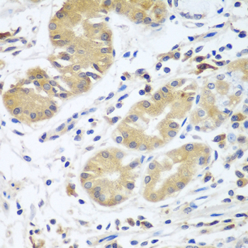 Anti-Complement factor D Polyclonal Antibody (CAB8117)