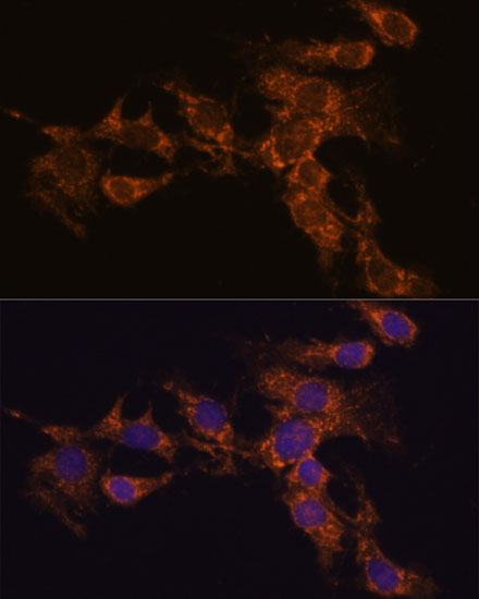 Anti-PYCR2 Antibody (CAB15155)