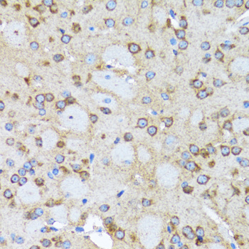 Anti-ACTR2 Antibody (CAB5734)