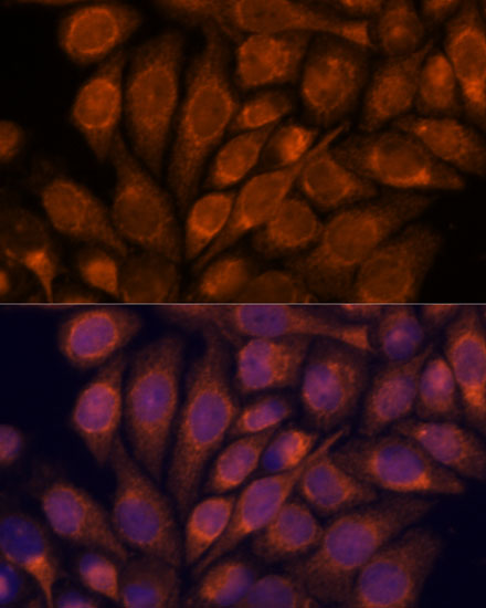 Anti-IPO4 Antibody (CAB15600)