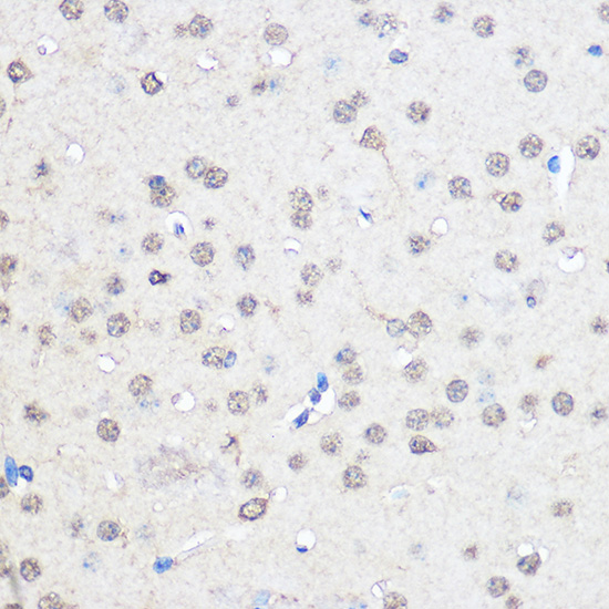 Anti-CNOT7 Polyclonal Antibody (CAB8959)