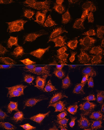 Anti-PTCD1 Antibody (CAB16219)