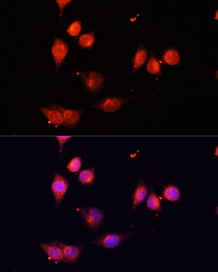 Anti-IKKEpsilon Antibody (CAB14093)