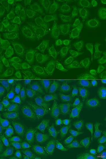 Anti-ICK Antibody (CAB7783)