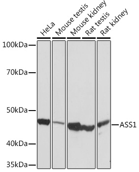 Anti-ASS1 Antibody (CAB9084)