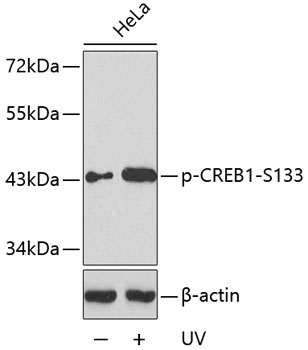 Anti-Phospho-CREB1-S133 Antibody (CABP0333)