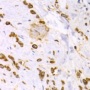 Anti-KRT15 Antibody (CAB2660)