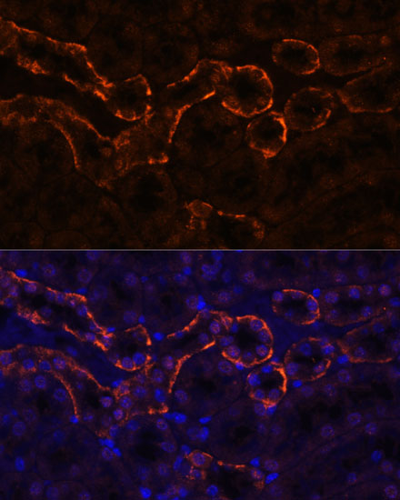 Anti-AQP3 Antibody (CAB2838)