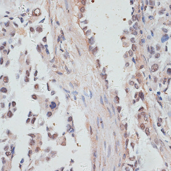 Anti-NCOA4 Antibody [KO Validated] (CAB5695)