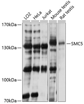 Anti-SMC5 Antibody (CAB2301)