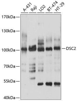 Anti-DSC2 Antibody (CAB10211)