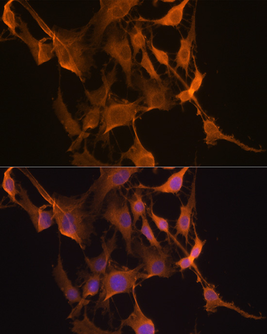 Anti-GPX4 Antibody (CAB13309)