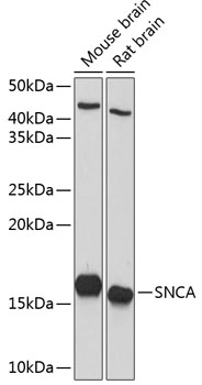 Anti-SNCA Antibody (CAB13354)