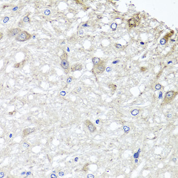 Anti-METTL13 Antibody (CAB7111)