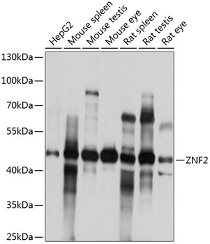 Anti-ZNF2 Antibody (CAB14381)