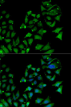 Anti-AIPL1 Antibody (CAB14113)