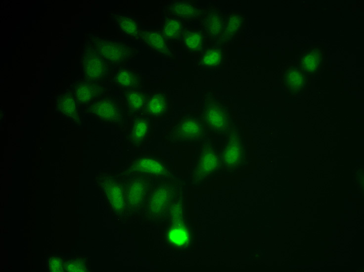 Anti-CHAT Antibody (CAB12420)