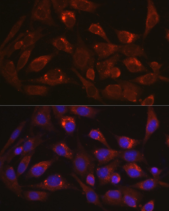 Anti-LAMP1 Antibody (CAB16894)