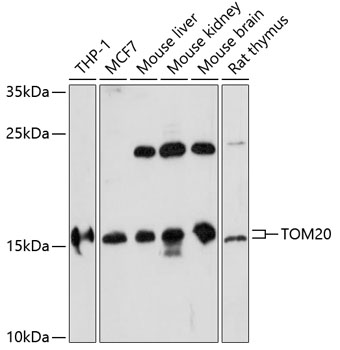 Anti-TOM20 Antibody (CAB16896)