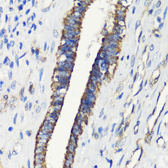 Anti-FKBP1A Antibody (CAB1763)