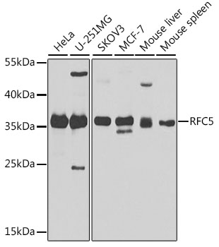 Anti-RFC5 Polyclonal Antibody (CAB8056)