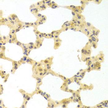Anti-IRF3 Antibody (CAB11373)