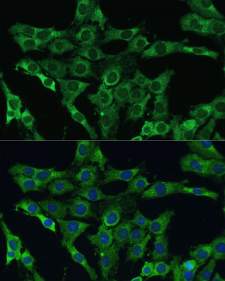 Anti-PLSCR3 Antibody (CAB12371)