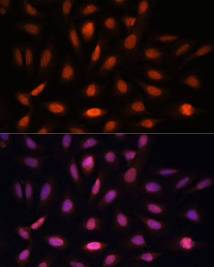 Anti-PPIL-4 Antibody (CAB15920)