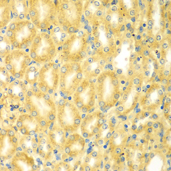 Anti-PDE4DIP Antibody (CAB7765)