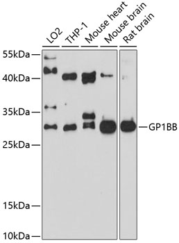 Anti-GP1BB Antibody (CAB10113)