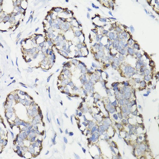 Anti-WASF3 Antibody (CAB16274)