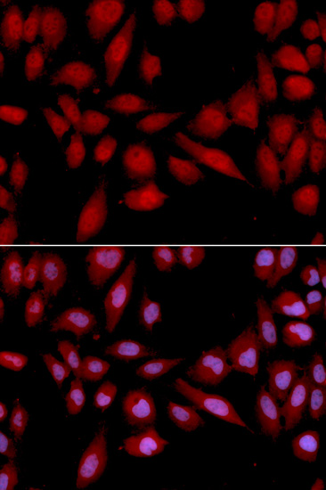 Anti-PSMA2 Antibody (CAB2504)