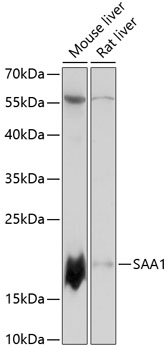 Anti-SAA1 Antibody (CAB14553)