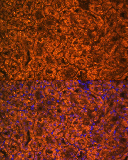 Anti-SCNN1A Antibody (CAB5538)