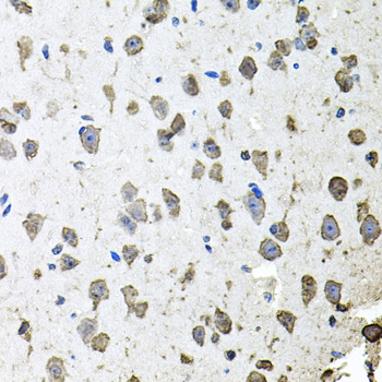 Anti-FGF1 Antibody (CAB0685)