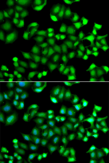 Anti-MAPKAPK3 Antibody (CAB7572)