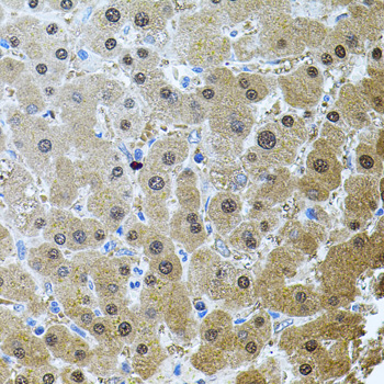 Anti-RNF166 Polyclonal Antibody (CAB8276)