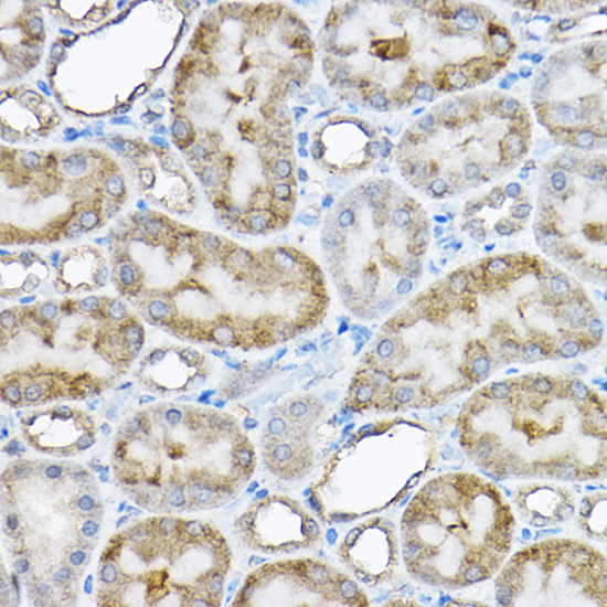 Anti-GRPEL2 Polyclonal Antibody (CAB8339)