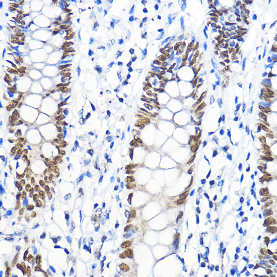 Anti-GTF2B Antibody (CAB1708)