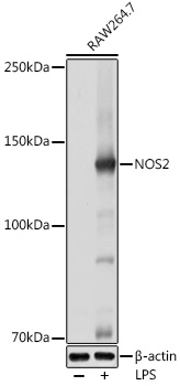 Anti-NOS2 Antibody (CAB18247)