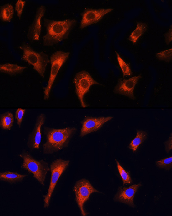 Anti-PINK1 Antibody (CAB7131)