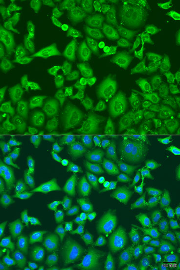 Anti-KIF11 Antibody (CAB7907)