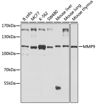 Anti-MMP9 Antibody [KO Validated] (CAB2095)