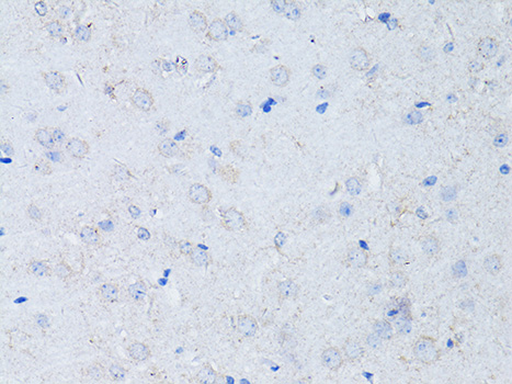 Anti-RYR2 Antibody (CAB0298)