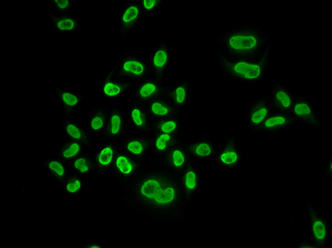 Anti-MCM6 Antibody (CAB1955)