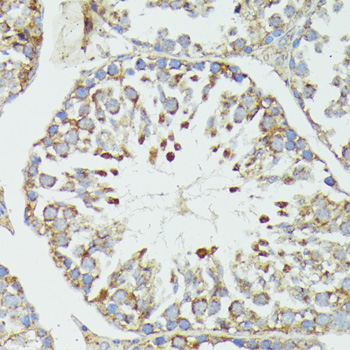 Anti-HSP70 Antibody (CAB12948)