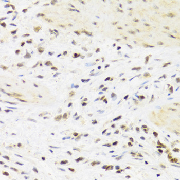 Anti-SUMO4 Antibody (CAB3100)