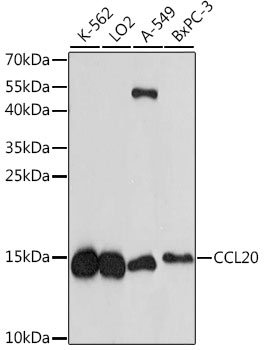 Anti-CCL20 Antibody (CAB1756)