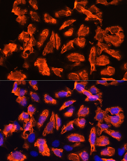 Anti-TCTN1 Antibody (CAB14929)