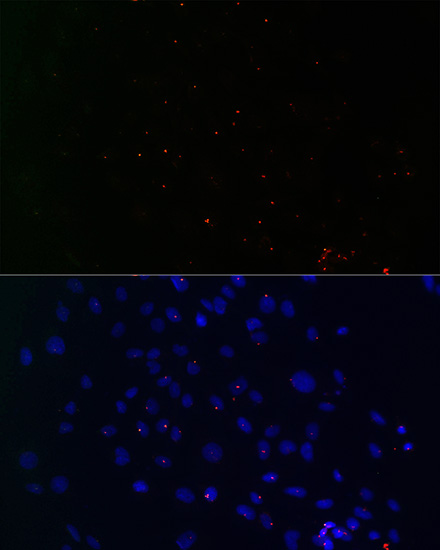 Anti-Centrin-3 Polyclonal Antibody (CAB8111)